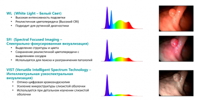 Многорежимная хромоэндоскопия